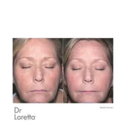 Dr Loretta Intense Replenishing Serum -Patchology Sales Intense Replenishing Serum add2 56311 3523 general