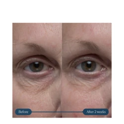 Elemis Pro-Collagen Vitality Eye Cream 3 Elemis Pro-Collagen Vitality Eye Cream - Image 3