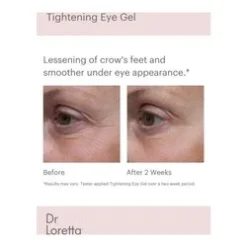 Dr Loretta Tightening Eye Gel -Patchology Sales Tightening Eye Gel add2 56316 5251 general